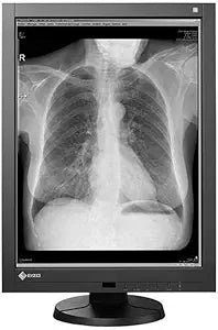 Eizo GX340 Radiforce 3MP Medical Diagnostic Monitor Renewed