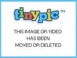 Polaroid PLLC72-11 Snap Mount Lens Cap for Sony HDR-NX5U