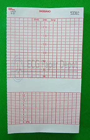 GE B4305AAO Fetal Monitoring Charts - 40 Packs, Red Grid