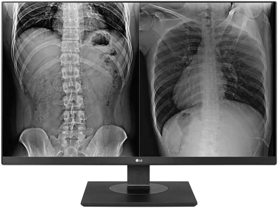 LG 27HJ713C-B 27" 4K IPS Clinical Review Monitor