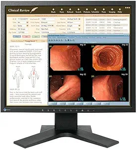 Eizo MX194 Radiforce 1MP 19-Inch Clinical Monitor