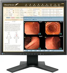 Eizo MX191 RadiForce 1MP Medical Radiology Monitor